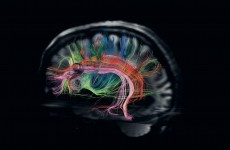 616244-cerebro-1080x864.jpg.imgw.1280.1280