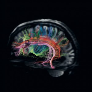 616244-cerebro-1080x864.jpg.imgw.1280.1280