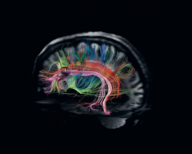 616244-cerebro-1080x864.jpg.imgw.1280.1280