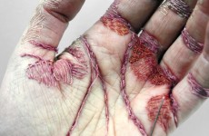 eliza-bennett-sews-thread-into-her-flesh-designboom-02