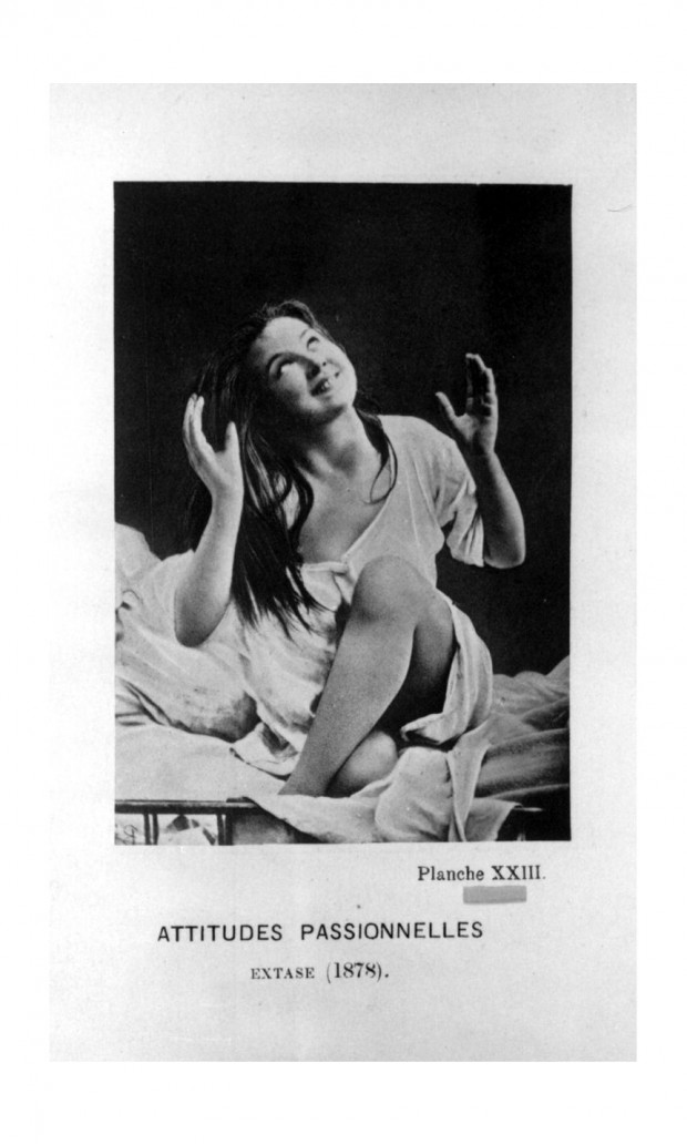 Der Neurologe und Pathologe Jean-Martin Charcot arbeitete Ende des 19. Jahrhunderts am Pariser Hôpital de la Salpêtrière. Sein Interesse galt der Erforschung einer rätselhaften Krankheit, der Hysterie, durch die genaue Dokumentierung in Zeichnungen und Fotografien. Seine Patientinnen setzte er unter Hypnose und untersuchte in diesem Zustand, die verschiedenen Stadien der "hysterischen" Frauen. Diese Aufnahme zeigt Patientin Augustine in Ekstase.